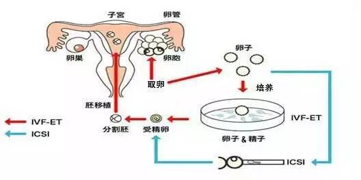 42岁试管